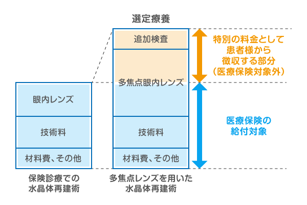 「選定療養」とは