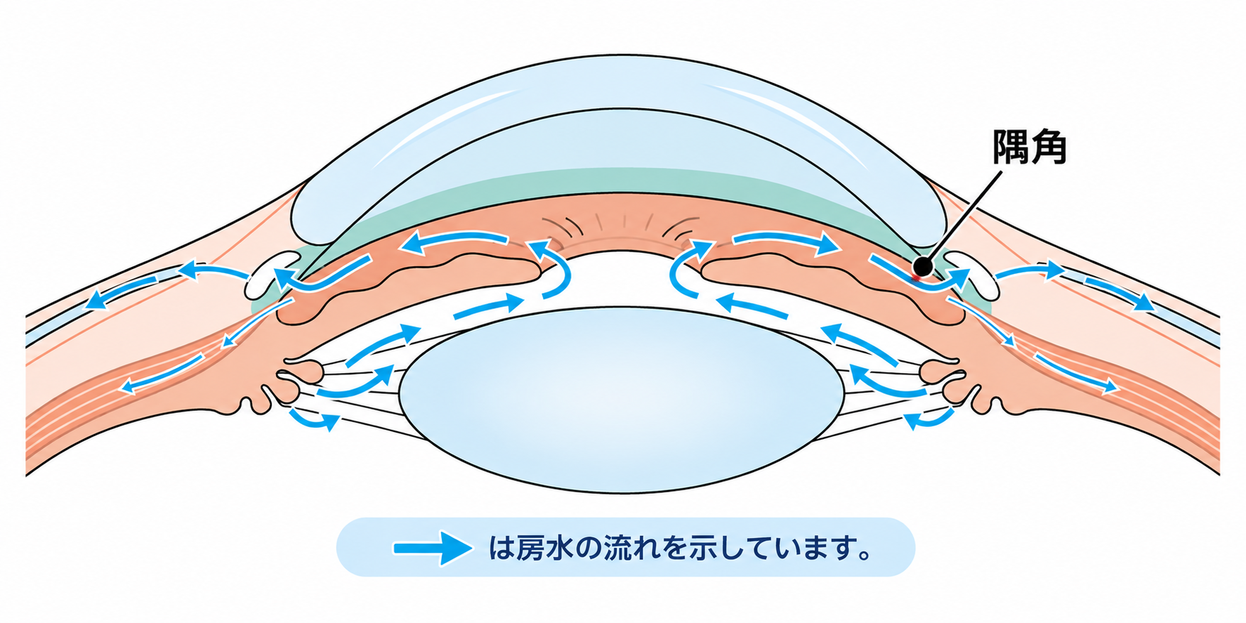房水の流れと隅角の解剖図